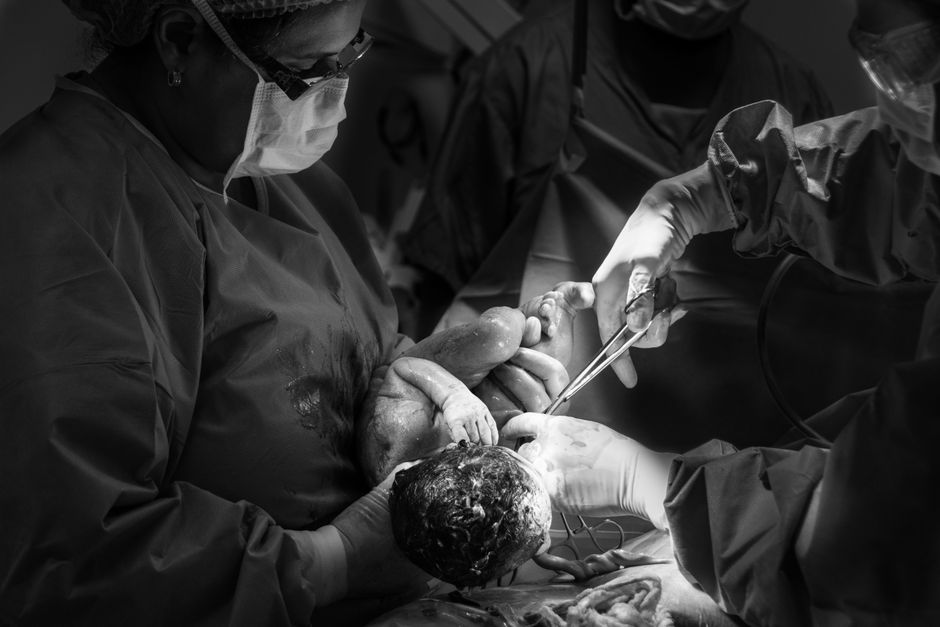 One in four births in England is now emergency caesarean, BBC analysis shows